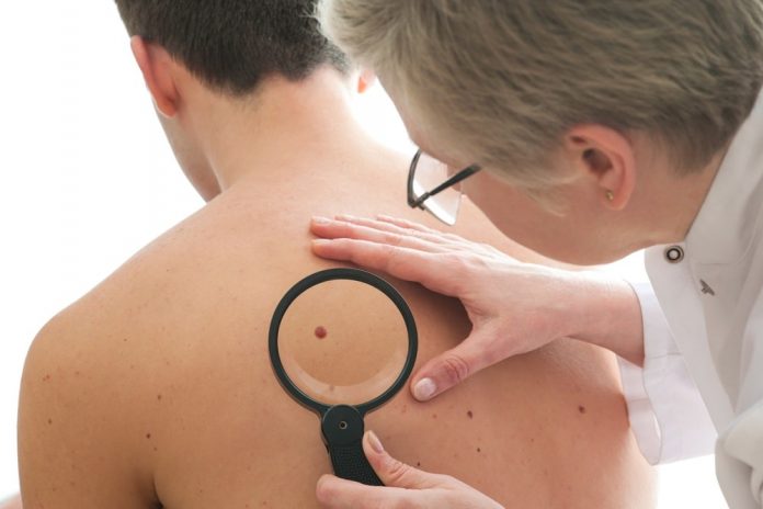 Skin Cancer Risks and Prevention